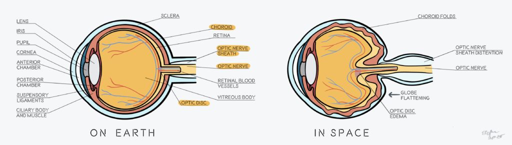 Gravity Gone: How Microgravity Affects the Human Body 01.02 sans
