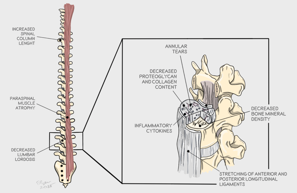 Gravity Gone: How Microgravity Affects the Human Body 01.03 gravity gone spine